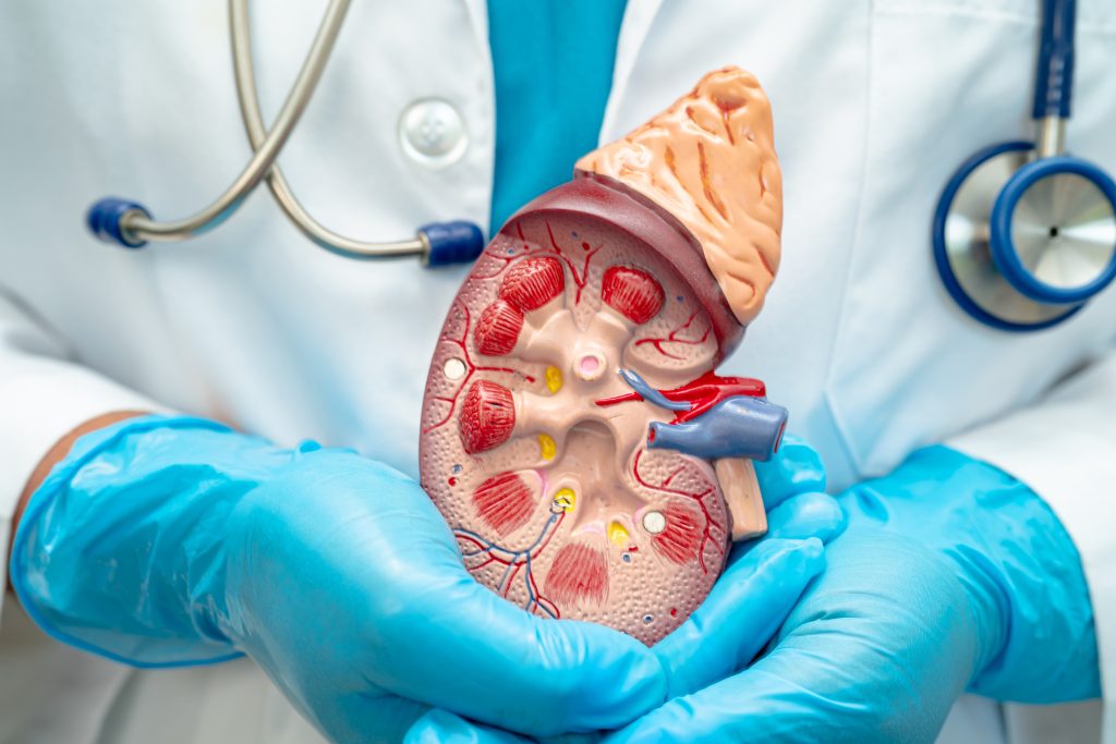 Böbrek Damarlarına Stent Takılması
