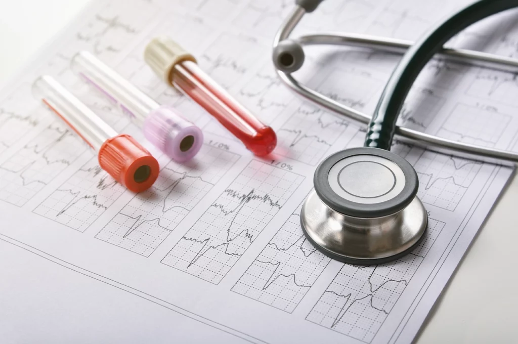 Kan Sonuçlarınız Kalp Krizi Riskinizi Söylüyor Olabilir