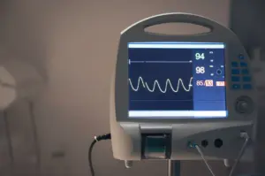 ekg