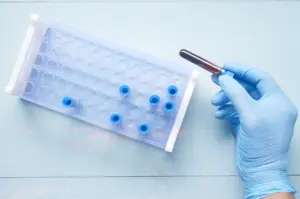 trigliserit seviyesi