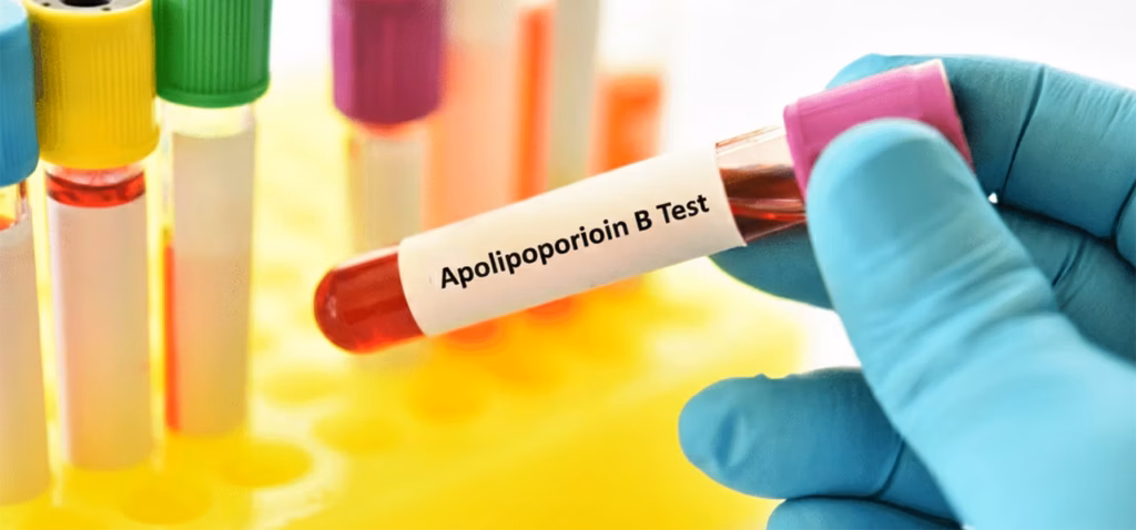 Apo B Nedir