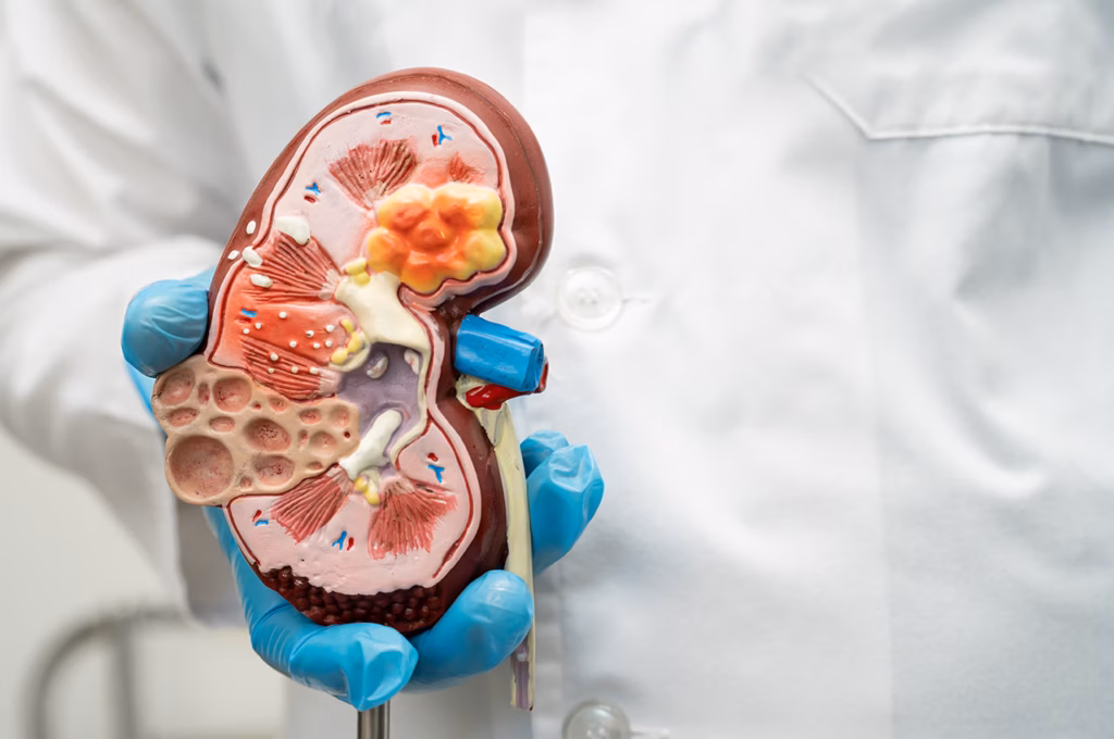 Böbrek Hastaları Oruç Tutabilir Mi