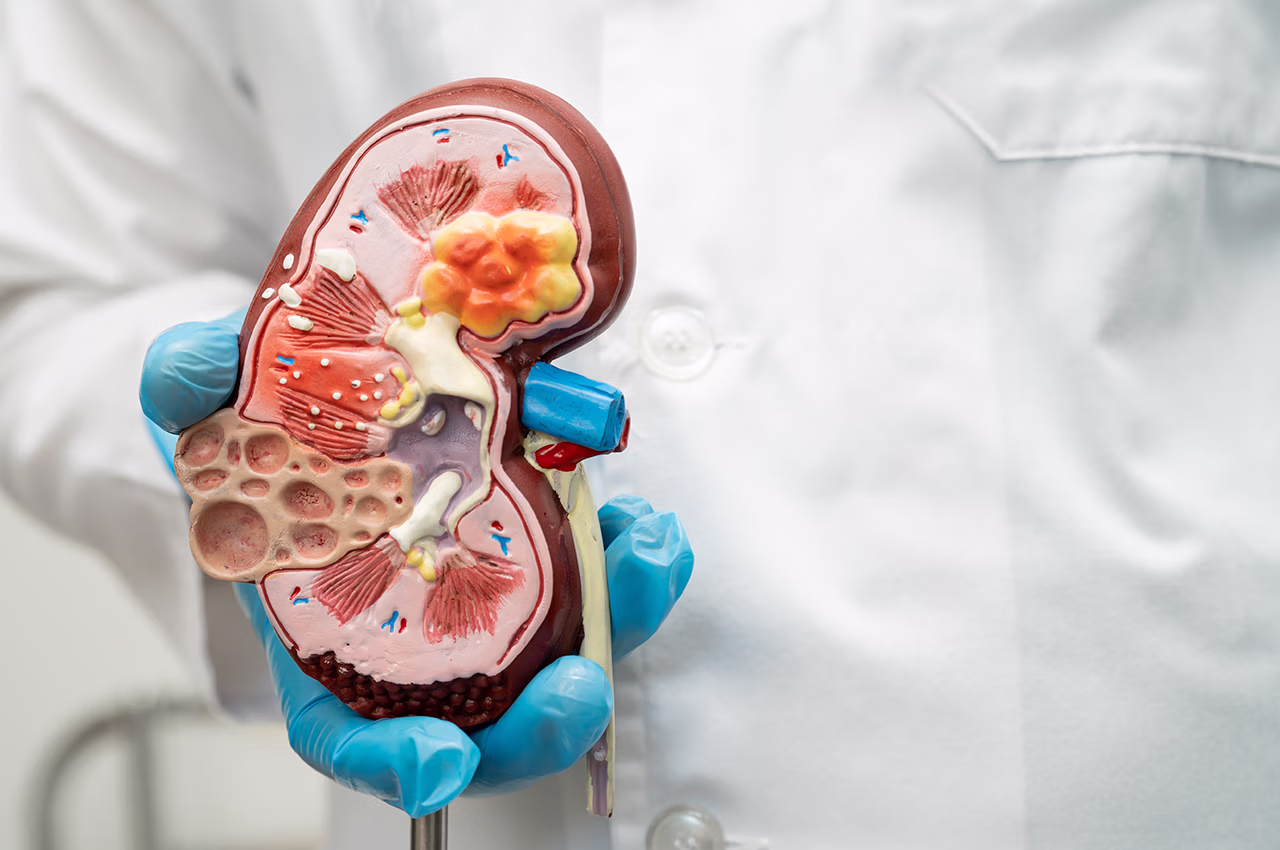 Böbrek Hastaları Oruç Tutabilir Mi