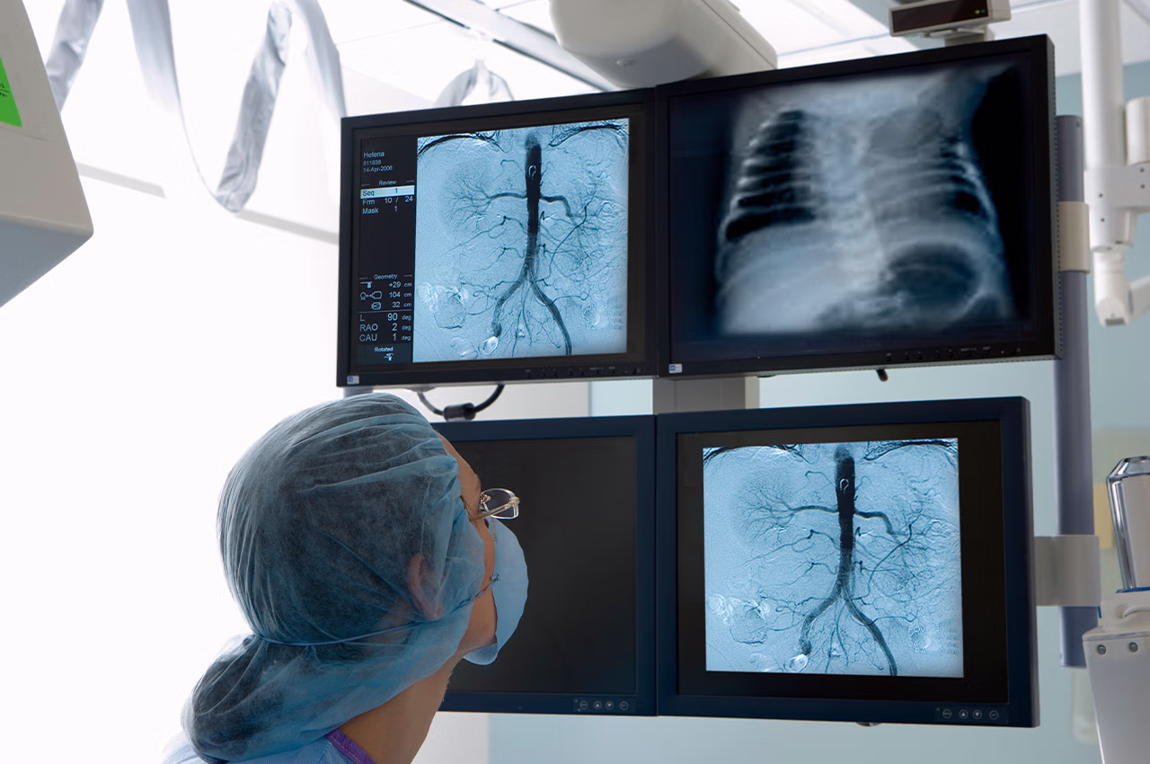 Anjiyo Sonrası İyileşme Süreci