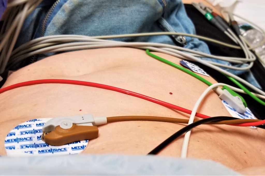 Holter EKG Nedir?