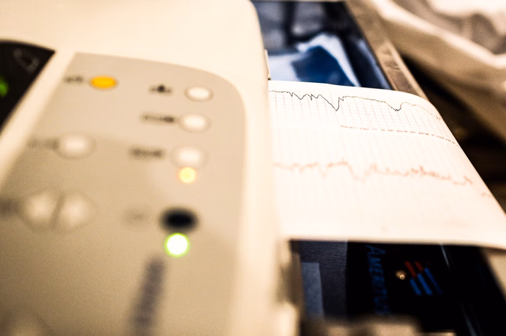 Kalp Damar Tıkanıklığı EKG İle Anlaşılır Mı