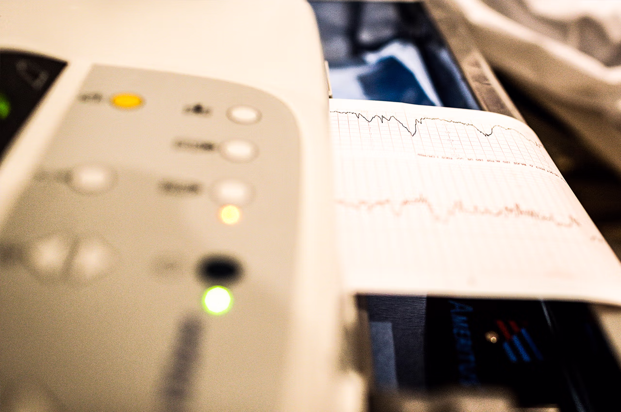 Kalp Damar Tıkanıklığı EKG İle Anlaşılır Mı