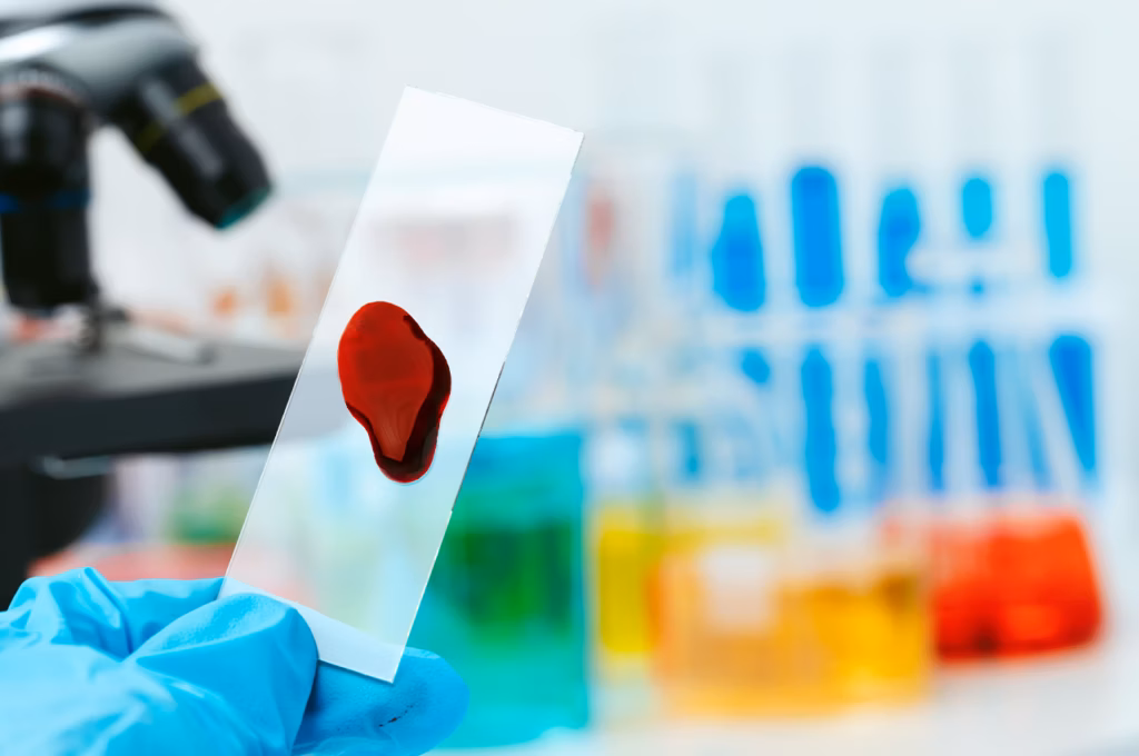 Antifosfolipid Sendromu
