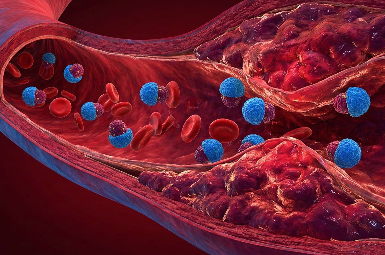 Damar İçi Görüntüleme