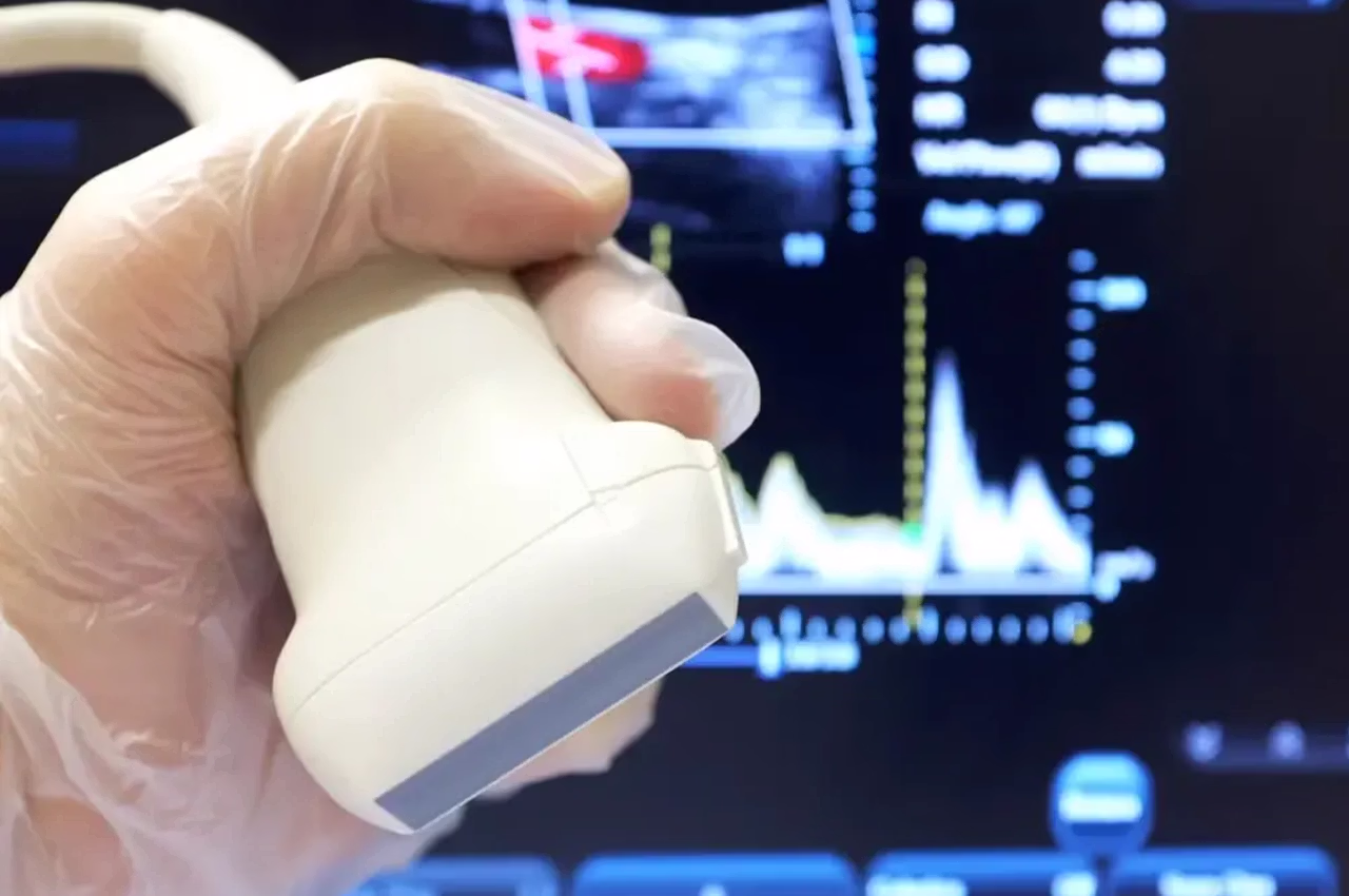 Damar Tıkanıklığı Hangi Cihazla Anlaşılır