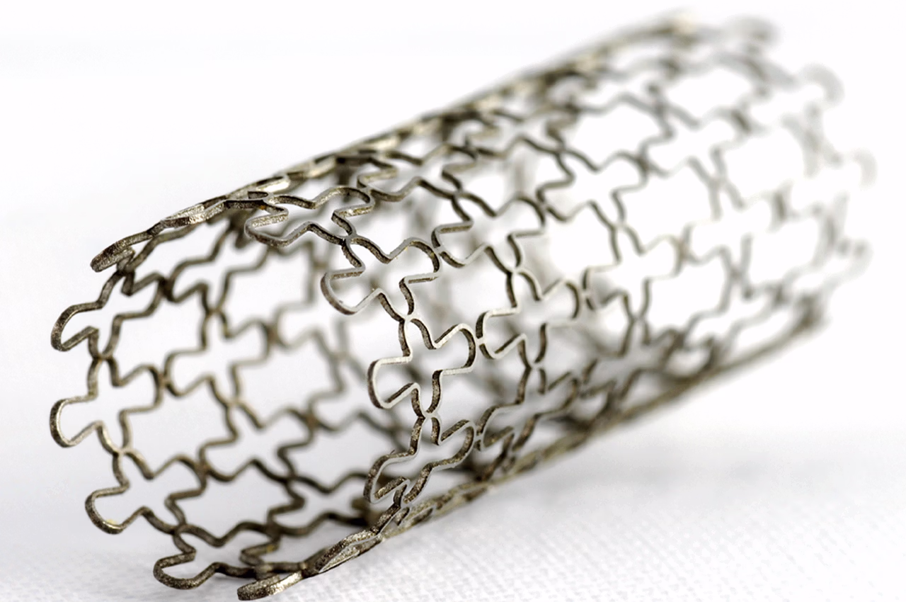 Stent Nedir