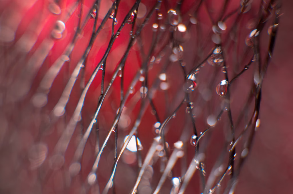 Stent Takılan Hasta Nelere Dikkat Etmeli